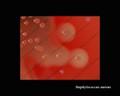 staphylococcus aureus